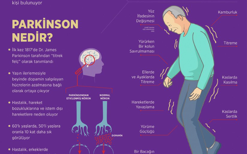 Parkinson Nedir? Evreleri ve Belirtileri nelerdir?